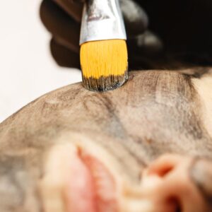 Forradalmi carbon peeling kezelés az Apollon Beauty kozmetikában